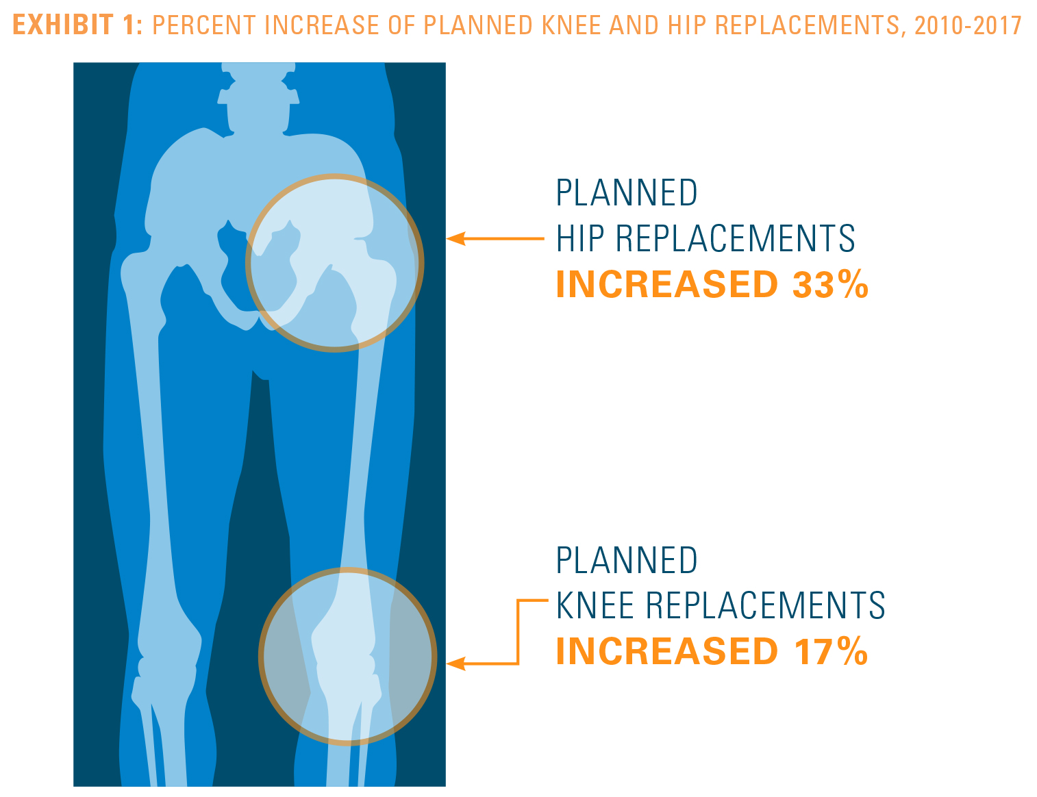 EXHIBIT 1: PERCENT INCREASE OF PLANNED KNEE AND HIP REPLACEMENTS, 2010-2017