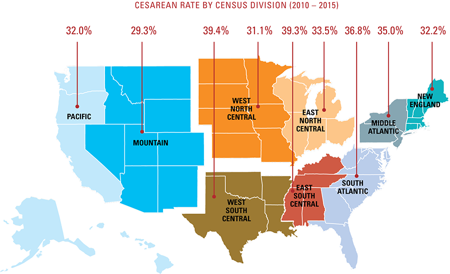 Cesarean rates by census division